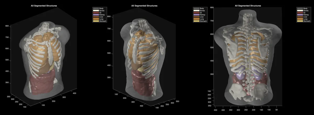 Midjourney CEO, 초음파 전신 스캐너 'Midjourney Scanner' 공개 — MRI 수준 화질 목표