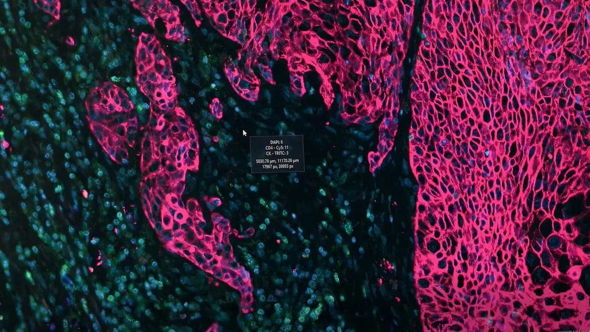 Nadella: AI로 병리 슬라이드를 공간 단백체학으로 전환 — 암 진단 비용·시간 단축